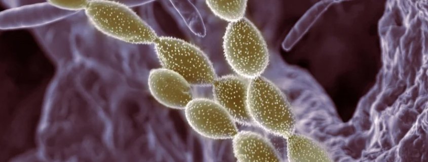 La diversità dei microbi nel suolo influisce positivamente sulla capacità di sequestro del carbonio. Foto: Alice Dohnalkova (distributed via imaggeo.egu.eu) Attribution 3.0 Unported (CC BY 3.0)