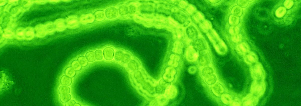 I cianobatteri, o alghe verde-azzurre, hanno un elevato contenuto di ferro e possono essere usati per produrre fertilizzanti biologici. Foto: Josef Reischig CC BY-SA 3.0 DEED Attribution-ShareAlike 3.0 Unported