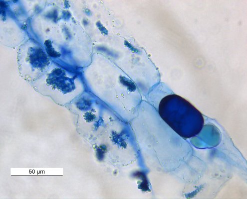 L'innesto dei funghi micorrizici favorisce la resa delle colture e rappresenta un'alternativa ai fertilizzanti chimici. Foto: Rajarshi Rit ATTRIBUTION 4.0 INTERNATIONAL CC BY 4.0 Deed