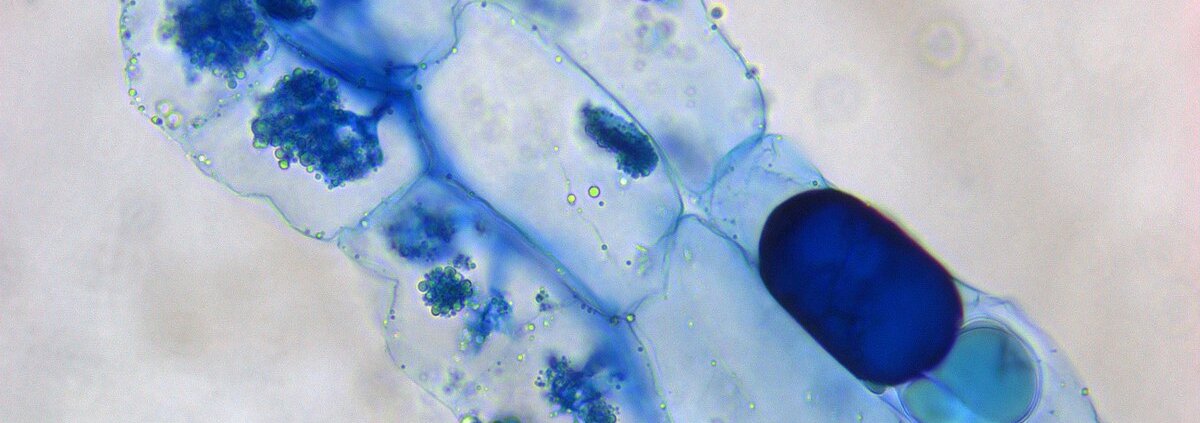 Grafting mycorrhizal fungi boosts crop yields and is an alternative to chemical fertilisers. Photo: Rajarshi Rit ATTRIBUTION 4.0 INTERNATIONAL CC BY 4.0 Deed