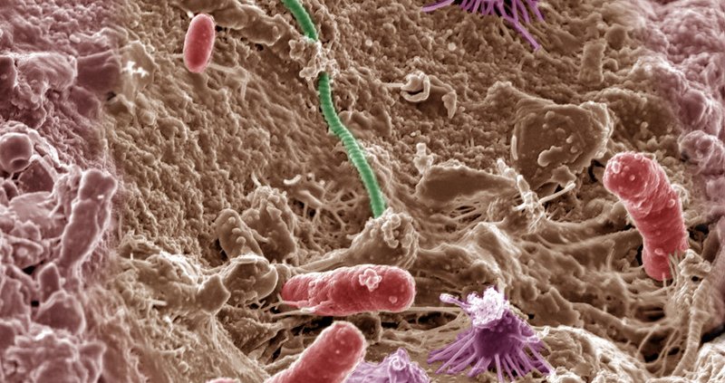 Il sequenziamento dei geni ha dimostrato come i batteri lavorino insieme per prosperare in contesti caratterizzati da diversi livelli di pH. Foto: Pacific Northwest National Laboratory - PNNL Attribution-NonCommercial-ShareAlike 2.0 Generic CC BY-NC-SA 2.0 Deed